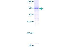 FBXW11 Protein (AA 1-529) (GST tag)