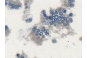 Detection of LSP1 in Rat Small intestine Tissue using Polyclonal Antibody to Lymphocyte Specific Protein 1 (LSP1)