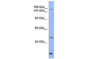WB Suggested Anti-ATP7A Antibody Titration:  0. (ATP7A anticorps  (Middle Region))