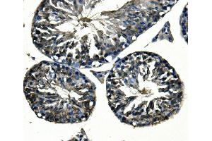 IHC analysis of Adam28 using anti-Adam28 antibody (ABIN7600945). (ADAM28 anticorps  (AA 26-195))