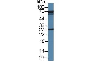 Detection of GLS in Mouse Kidney lysate using Polyclonal Antibody to Glutaminase (GLS)