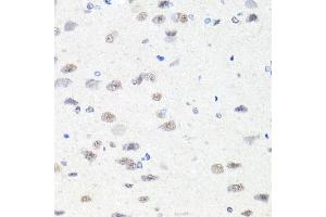 Immunohistochemistry of paraffin-embedded rat brain using CHD1 antibody (ABIN5975217) at dilution of 1/100 (40x lens). (CHD1 anticorps)