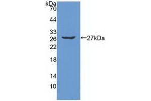 Detection of Recombinant PRSS2, Human using Polyclonal Antibody to Protease, Serine 2 (PRSS2) (PRSS2 anticorps  (AA 24-241))
