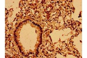 Immunohistochemistry of paraffin-embedded human lung tissue using ABIN7142932 at dilution of 1:100