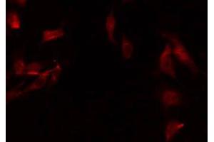 ABIN6275271 staining HuvEc by IF/ICC.