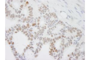 anti-DEAD (Asp-Glu-Ala-Asp) Box Polypeptide 24 (DDX24) (C-Term) antibody