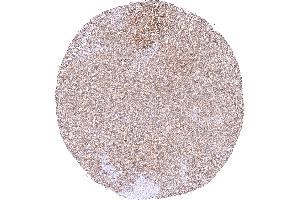 Moderate predominantly cytoplasmic MTAP staining of ovarian stroma cells (Recombinant MTAP anticorps  (AA 95-197))