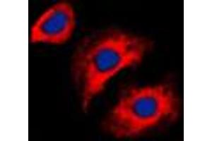 Immunofluorescent analysis of Collagen 3 alpha 1 staining in HeLa cells.