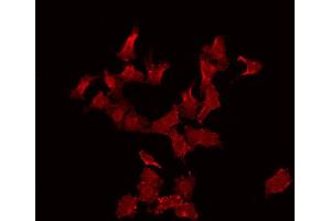 ABIN6272262 staining Hela by IF/ICC.