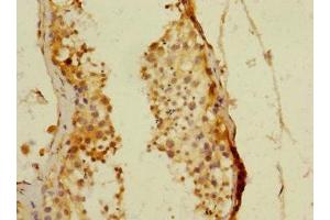 Immunohistochemistry of paraffin-embedded human testis tissue using ABIN7160526 at dilution of 1:100 (PDE4DIP anticorps  (AA 1-310))