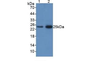 Figure. (Lipocalin 2 anticorps  (AA 21-198))