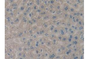 Detection of PLA2R1 in Mouse Liver Tissue using Polyclonal Antibody to Phospholipase A2 Receptor 1 (PLA2R1) (PLA2R1 anticorps  (AA 1418-1487))