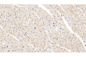 Detection of SEMA5B in Human Cardiac Muscle Tissue using Polyclonal Antibody to Semaphorin 5B (SEMA5B)
