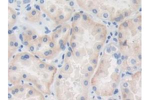 DAB staining on IHC-P; Samples: Human Kidney Tissue (TRAF4 anticorps  (AA 193-444))