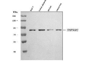 Western blot analysis of SHROOM1 using anti-SHROOM1 antibody (ABIN7601525).