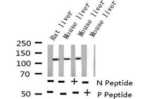 Western blot analysis of Phospho-EGFR (Ser695) expression in various lysates