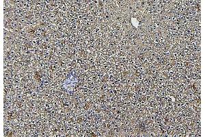 IHC analysis of ALDOB using anti-ALDOB antibody (ABIN7602563). (ALDOB anticorps  (AA 85-364))