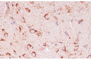 Immunohistochemistry of paraffin-embedded Rat brain using ENTPD6 Polyclonal Antibody at dilution of 1:100 (40x lens). (ENTPD6 anticorps)