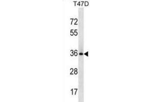 Western Blotting (WB) image for anti-BCL2-Like 12 (Proline Rich) (BCL2L12) antibody (ABIN3000719)