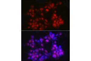 Immunofluorescence analysis of LNCaP cells using NKX3. (NKX3-1 anticorps)