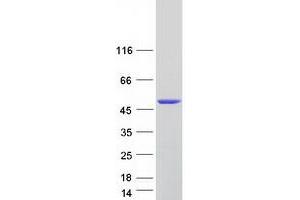 Validation with Western Blot