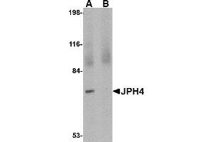 Western Blotting (WB) image for anti-Junctophilin 4 (JPH4) (C-Term) antibody (ABIN1030461) (Junctophilin 4 anticorps  (C-Term))
