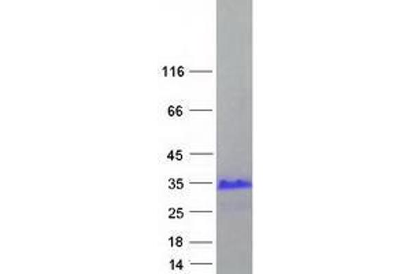 X Antigen Family, Member 3 (XAGE3) (Transcript Variant 2) protein (Myc-DYKDDDDK Tag)