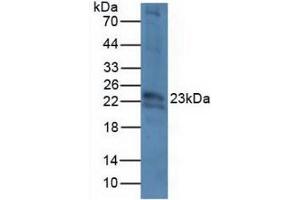 Figure. (CRYbB2 anticorps  (AA 17-191))