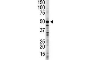 GSK3B antibody used in western blot to detect GSK3B in 293 cell lysate.