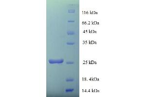 SDS-PAGE (SDS) image for Prion Protein (PRNP) (AA 29-231) protein (His tag) (ABIN5710151)