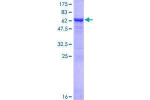 Image no. 1 for Kinetochore-associated protein DSN1 homolog (DSN1) (AA 1-356) protein (GST tag) (ABIN1352040)