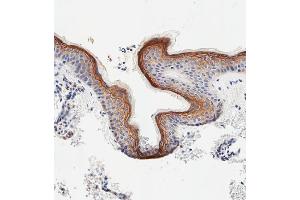 Immunohistochemical analysis of paraffin-embedded human skin tissue using C performed on the Leica® BOND RXm.