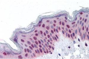 anti-RuvB-Like 2 (E. Coli) (RUVBL2) (AA 304-458) antibody