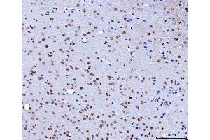 IHC analysis of HnRNP H/HNRNPH1 using anti-HnRNP H/HNRNPH1 antibody (ABIN4886623). (HNRNPH1 anticorps  (N-Term))