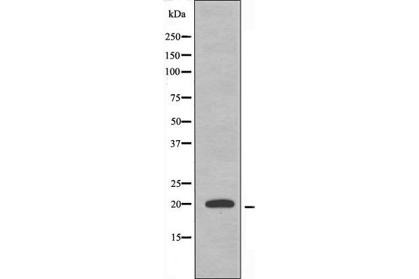 MRPL51 anticorps  (C-Term)