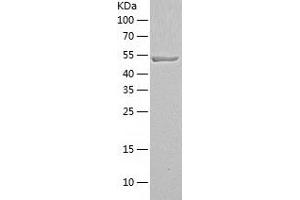Western Blotting (WB) image for Proteasome (Prosome, Macropain) 26S Subunit, Non-ATPase, 5 (PSMD5) (AA 1-504) protein (His tag) (ABIN7124616)