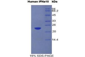 SDS-PAGE (SDS) image for Interferon, alpha 10 (IFNa10) (AA 24-189) protein (His tag) (ABIN1981196) (IFNA10 Protein (AA 24-189) (His tag))