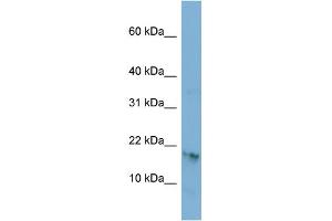 WB Suggested Anti-C17orf64 Antibody Titration: 0. (C17orf64 anticorps  (Middle Region))
