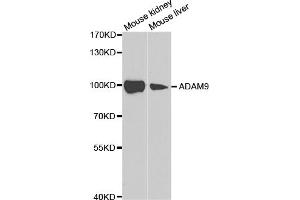 Western blot analysis of extracts of various cell lines, using ADAM9 antibody (ABIN5973121) at 1/1000 dilution. (ADAM9 anticorps)
