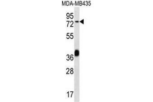 CEL Antibody (Center) western blot analysis in MDA-MB435 cell line lysates (35µg/lane).