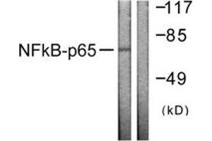 Western blot analysis of extracts from HeLa cells, using NF-kappaB p65 (Ab-505) Antibody. (NF-kB p65 anticorps  (AA 471-520))