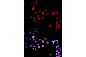 Immunofluorescence analysis of U2OS cell using Phospho-MAX-S11 antibody. (MAX anticorps  (pSer11))