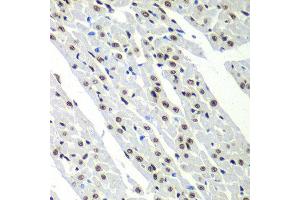Immunohistochemistry of paraffin-embedded rat heart using SF3B2 antibody at dilution of 1:100 (40x lens). (SF3B2 anticorps)