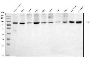 Western blot analysis of NSF using anti-NSF antibody (ABIN7601630).