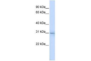 METTL5 antibody used at 1 ug/ml to detect target protein. (METTL5 anticorps  (N-Term))