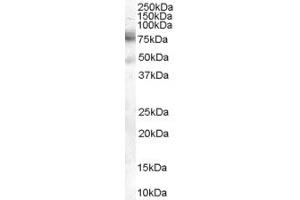 Western Blotting (WB) image for anti-DCP1 Decapping Enzyme Homolog A (S. Cerevisiae) (DCP1A) (AA 571-581) antibody (ABIN294525) (DCP1A anticorps  (AA 571-581))