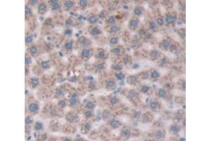 Used in DAB staining on fromalin fixed paraffin- embedded Kidney tissue (CD109 anticorps  (AA 719-965))