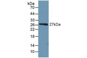 Detection of Recombinant PCK1, Mouse using Polyclonal Antibody to Phosphoenolpyruvate Carboxykinase 1, Soluble (PCK1) (PCK1 anticorps  (AA 312-563))