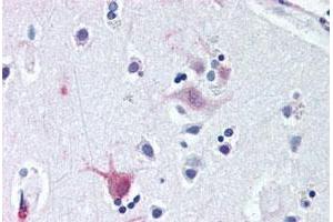 Immunohistochemical staining of human brain, cortex with WNT8B polyclonal antibody . (WNT8B anticorps  (C-Term))