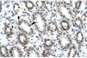 Rabbit Anti-HEY1 Antibody ,Paraffin Embedded Tissue: Human Kidney  Cellular Data: Epithelial cells of renal tubule  Antibody Concentration: 4. (HEY1 anticorps  (C-Term))